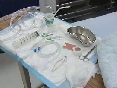 nazogastrik sonda uygulaması